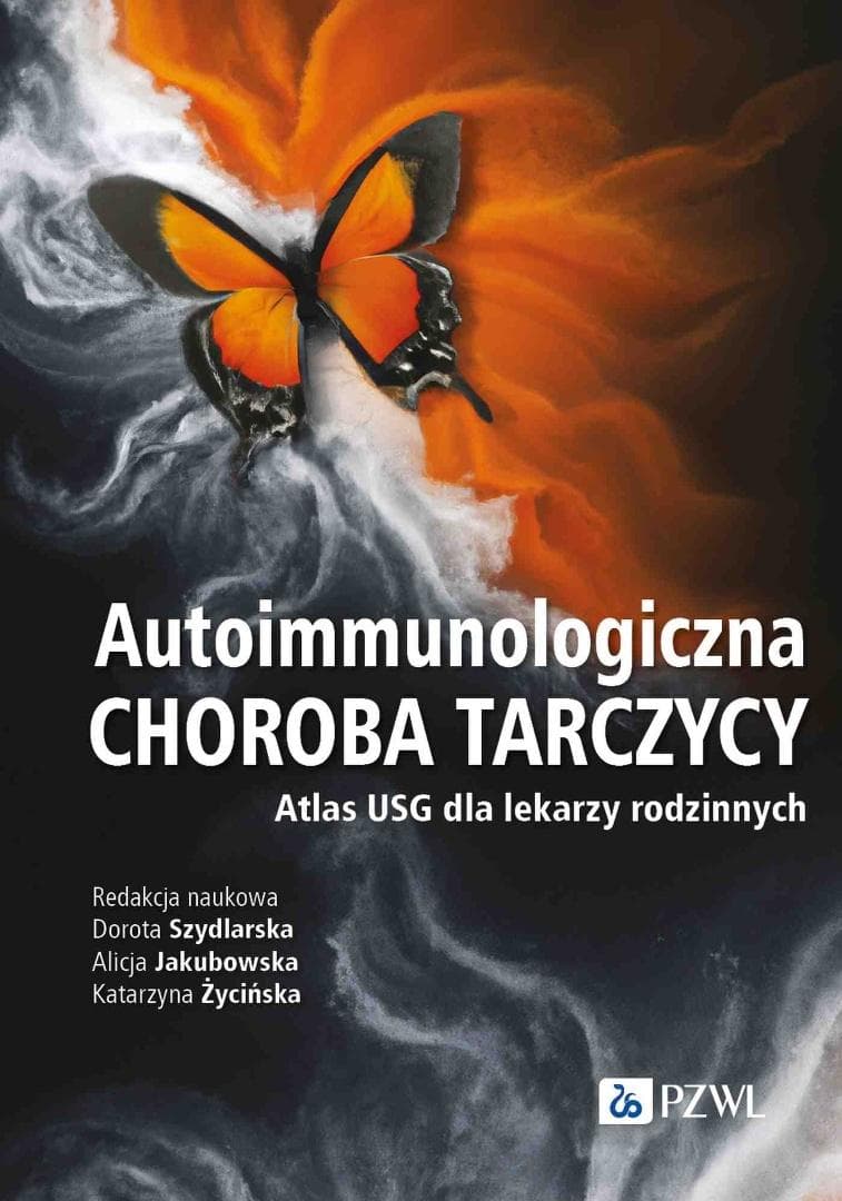 Autoimmunologiczna choroba tarczycy Atlas USG Dorota Szydlarska
