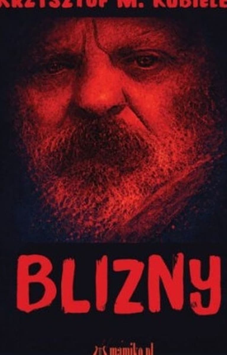 Blizny