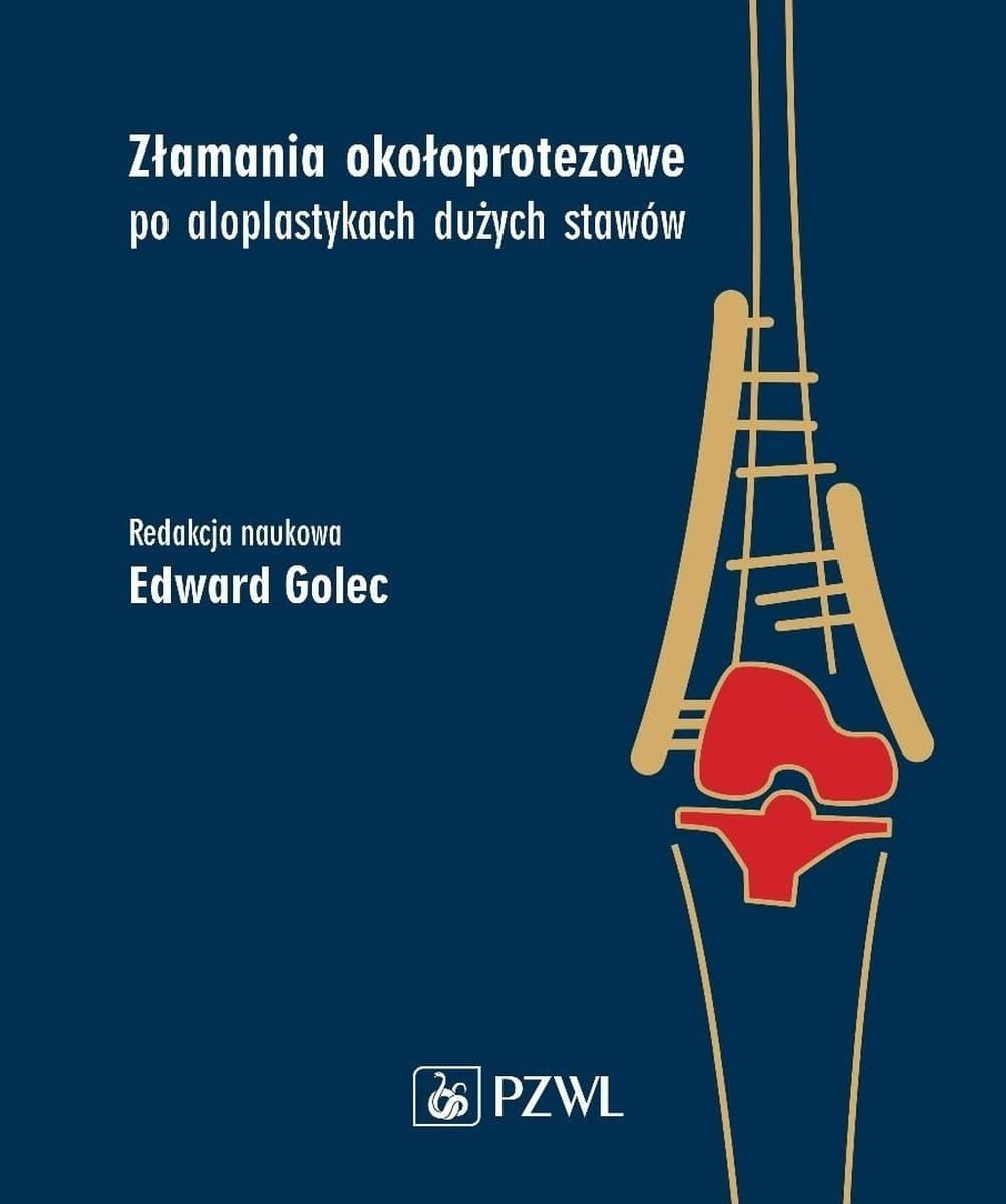 Złamania okołoprotezowe po aloplastykach stawów - Edward Golec