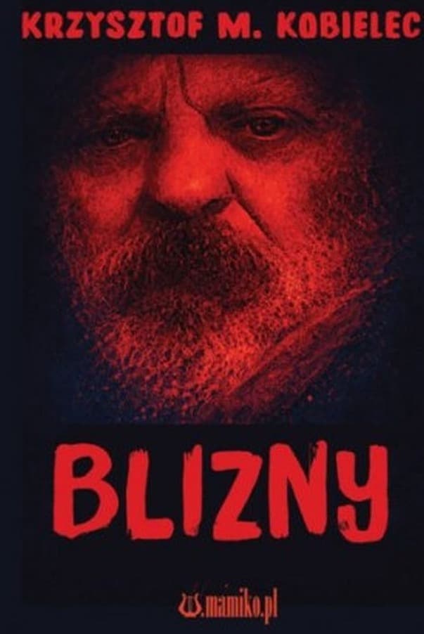 Blizny