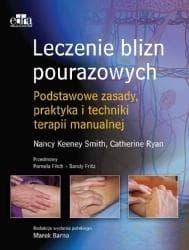 Leczenie blizn pourazowych - C. Ryan, N. Keeney-Smith