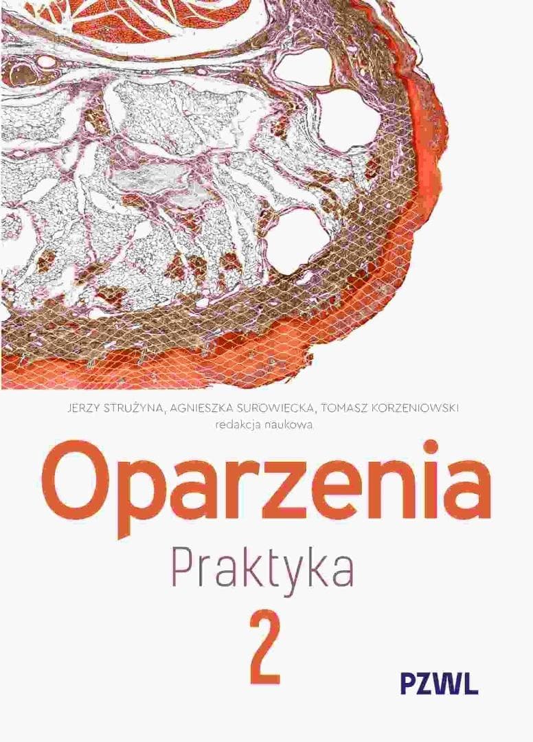 Oparzenia Praktyka Tom 2 - Strużyna Surowiecka Korz Medycyna ratunkowa 389 stron