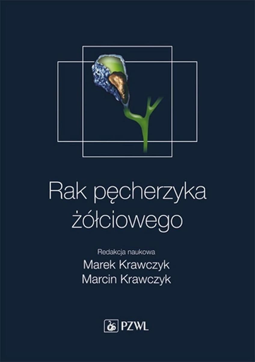Rak pęcherzyka żółciowego - monografia medyczna PZWL