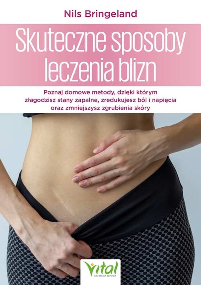 Skuteczne sposoby leczenia. Blizny